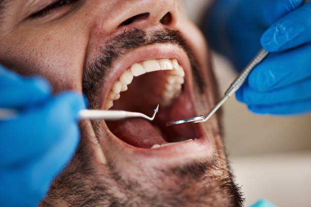 Best Periodontal (Gum) Disease Treatment  in Valdese, NC